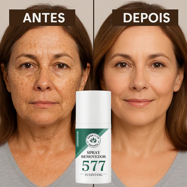 Spray Removedor 577 – Elimine Manchas de Sol, Idade e Melasma com 40% OFF + Frete Grátis!
