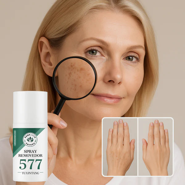 Spray Removedor 577 – Elimine Manchas de Sol, Idade e Melasma com 40% OFF + Frete Grátis!
