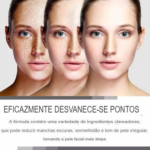 Correção Facial de Melanina, Corretor de Manchas Pretas:Melanin Correcting Facial NutriGlow