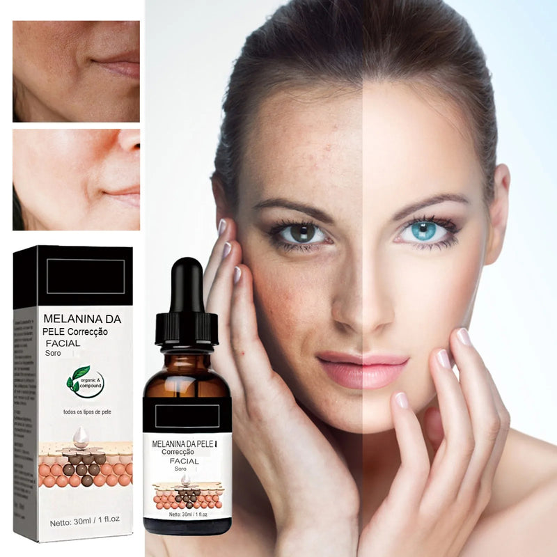Correção Facial de Melanina, Corretor de Manchas Pretas:Melanin Correcting Facial NutriGlow