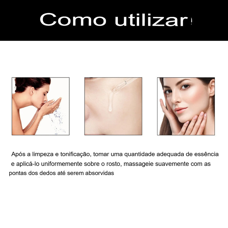 Correção Facial de Melanina, Corretor de Manchas Pretas:Melanin Correcting Facial NutriGlow