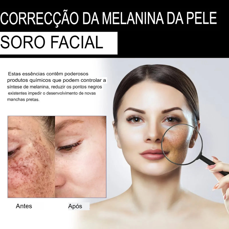 Correção Facial de Melanina, Corretor de Manchas Pretas:Melanin Correcting Facial NutriGlow